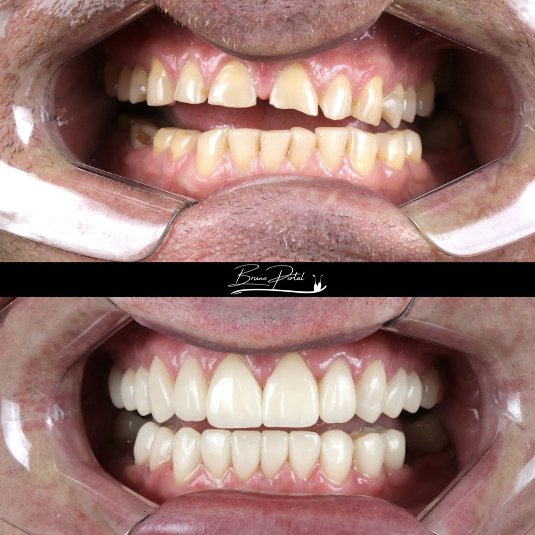 Caso 03: antes e depois